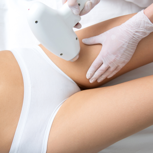 laser hair removal near bikini line